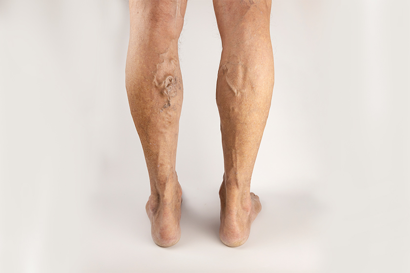 Diagnosis  and treatment of vascular malformations